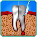 Гемисекция зуба: цена и особенности проведения