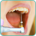 Распломбировка корневых каналов зуба